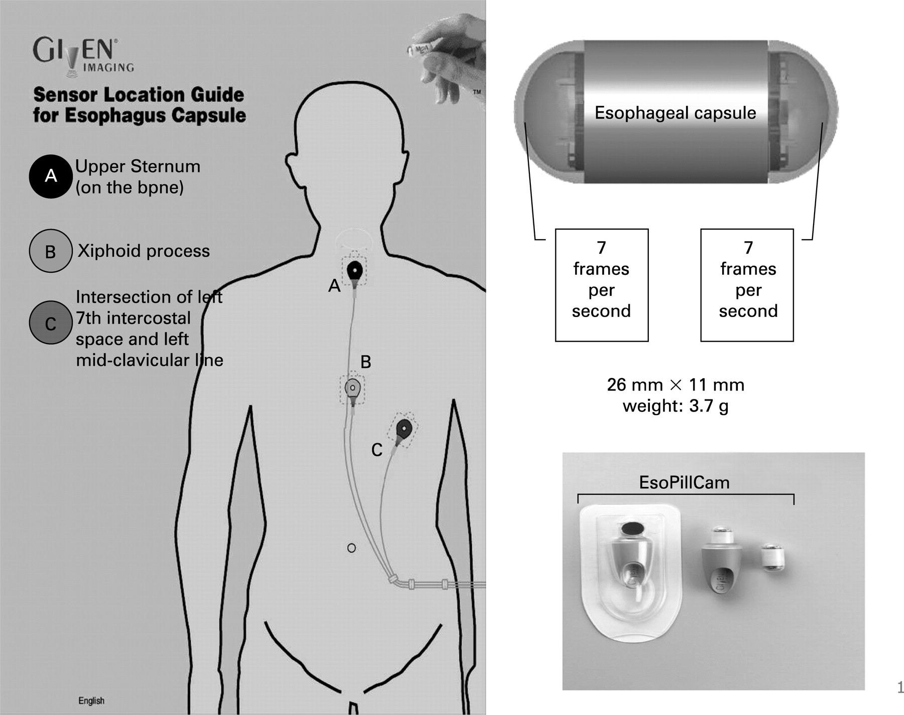 Capsule Endoscopy Procedure