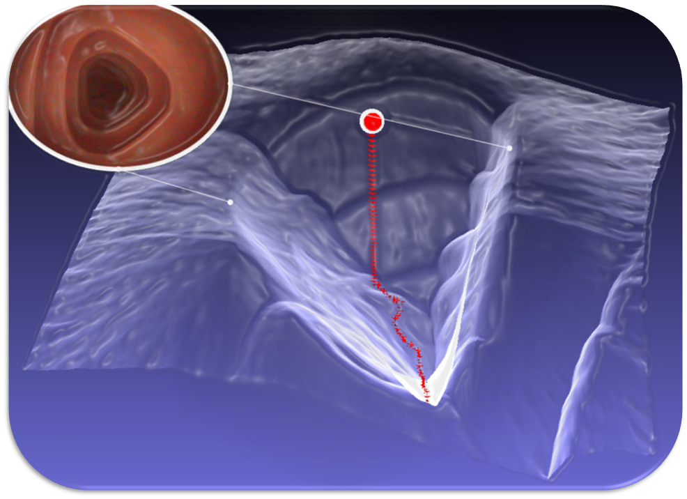 Capsule Endoscopy Procedure Code